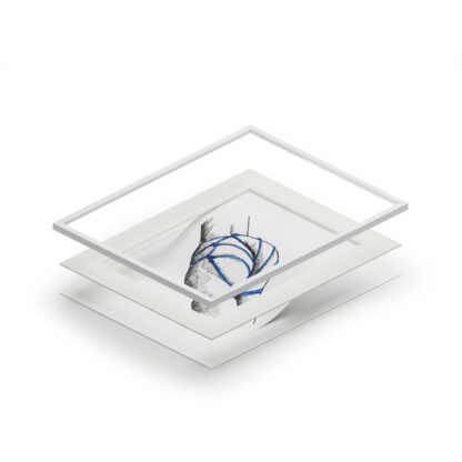 Basketcase - Fine Shibari Art Prints - Bondage, BDSM, Fetish - Image 3